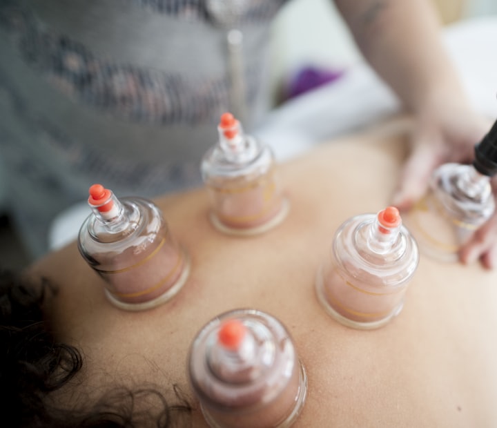 Cupping massage